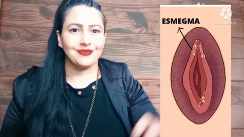 ESMEGMA NA MULHER Onde se acumula? (Grazy Dutra)